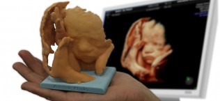 Baby3DPrint