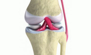 Ligamento Beñat Insunza